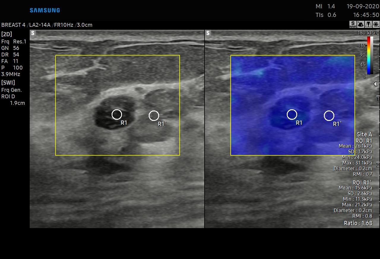 4 page SHEARWAVE IMAGING