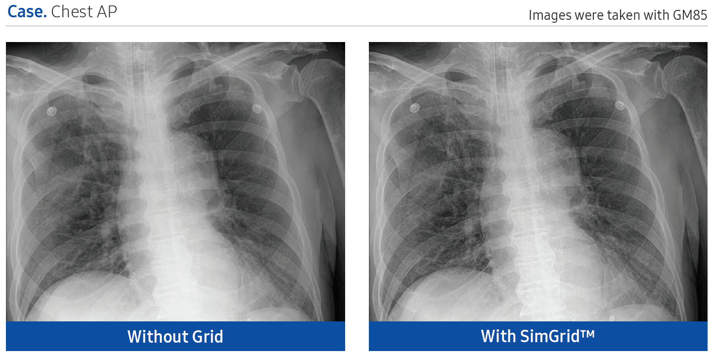 simgrid2