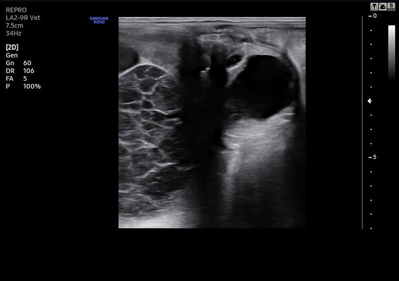 CTH Rt ovary-1