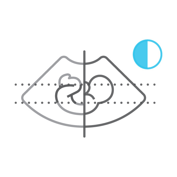 S-Harmonic-1